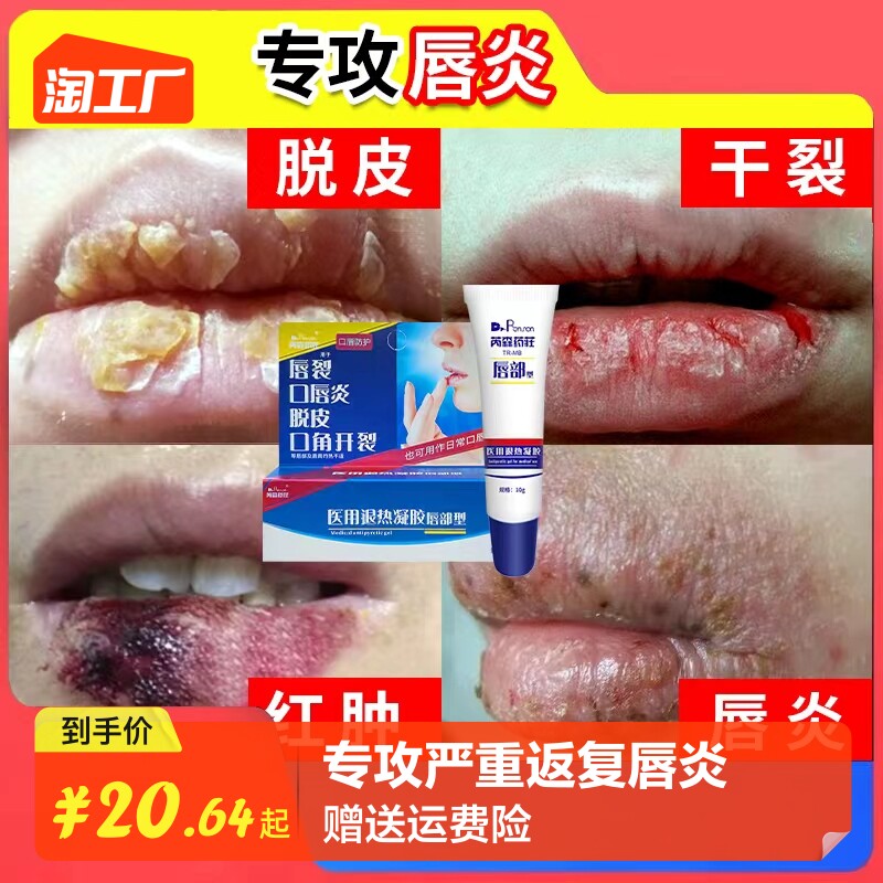 88vip概率券yuwell鱼跃幽门螺旋杆菌检测试剂盒hp胶体金法1人份盒